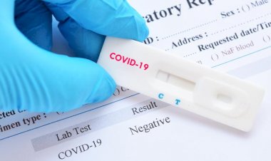 Hasil Rapid Test Positif, Dinkes Kota Sungaipenuh Dikabarkan Jemput Warga Pondok Agung