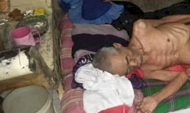 Icing, Kakek Miskin di Banten, Badan Tinggal Tulang Tak Dapat Bantuan Bansos Pemerintah