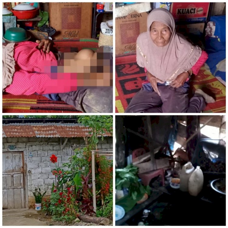 Derita Hernia Sejak Puluhan Tahun, Nenek di Siulak Kerinci Ini Butuh Uluran Tangan