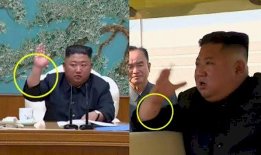 Teka-teki Jahitan Operasi Kim Jong-un Masih Misteri