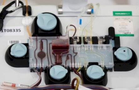 RS Inggris Uji Coba Pengobatan Plasma Darah Pasien COVID-19, Begini Caranya...