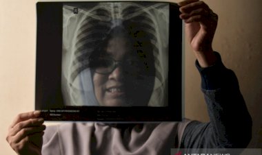 Berkurang 11 Orang, Jumat RSD Wisma Atlet Rawat 614 Pasien