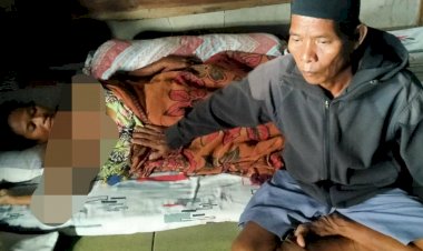 3 Tahun Idap Kanker Payudara, Wanita di Kualajambi Tanjab Timur Ini Butuh Perhatian