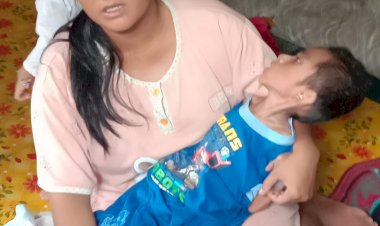 Derita Gizi Buruk Selama 9 Tahun, Kondisi Bocah di Tanjab Barat Ini Kian Memperihatinkan