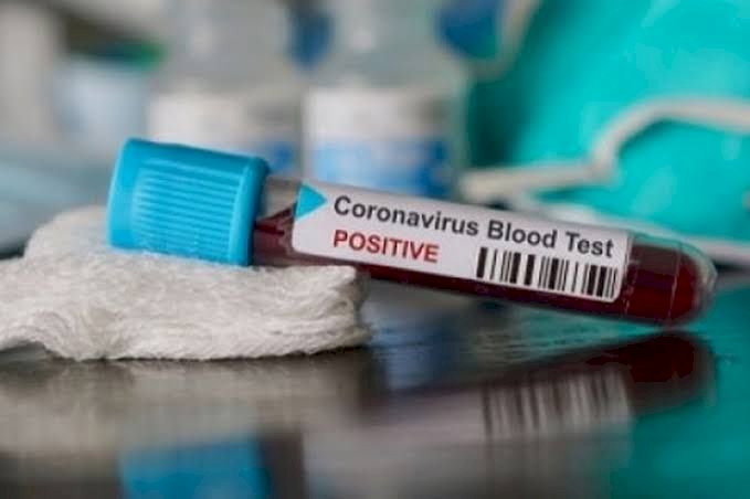 Rapid Test Pedagang di Sungaibahar, 5 Pedagang Reaktif