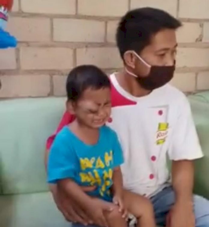 Derita Kanker di Mata, Bocah Berusia 4 Tahun di Sungaipenuh Ini Butuh Perhatian