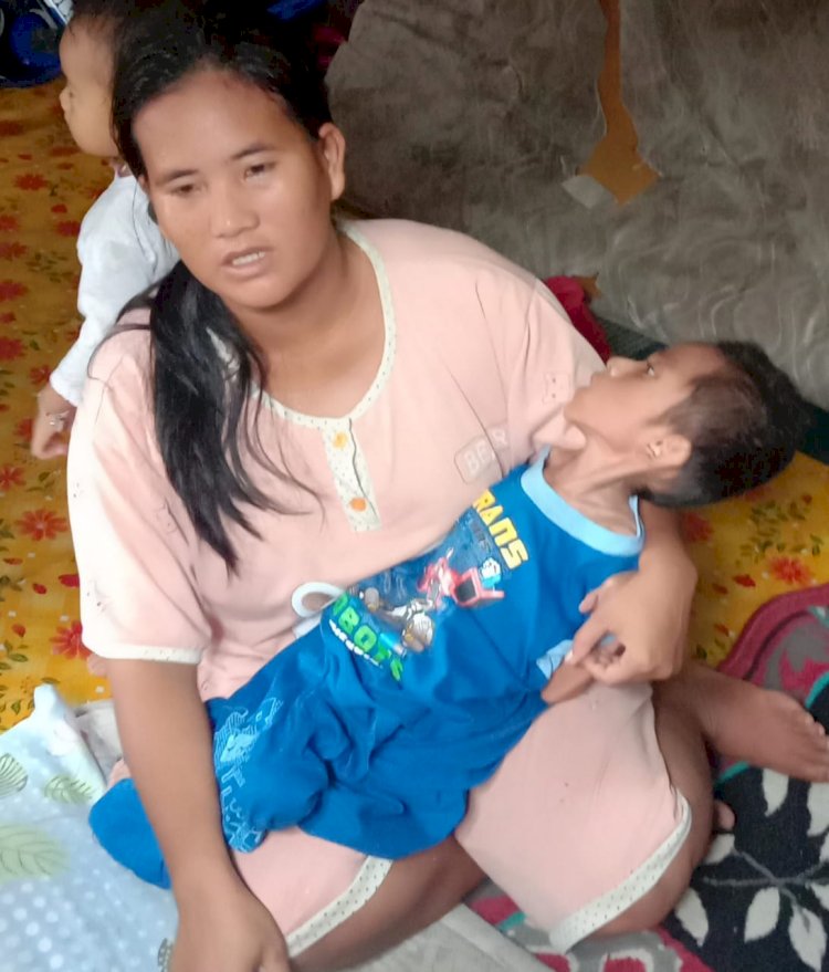 Derita Gizi Buruk Selama 9 Tahun, Kondisi Bocah di Tanjab Barat Ini Kian Memperihatinkan