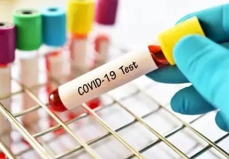 Update! COVID-19 20 Juni 2020: Positif Tembus 45.029 Orang, Bertambah 1.226 Kasus