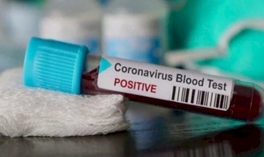 Wakil Gubernur Sulawesi Tenggara Terkonfirmasi Positif COVID-19