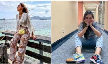 Patah Tulang, Begini Kondisi Terkini Luna Maya