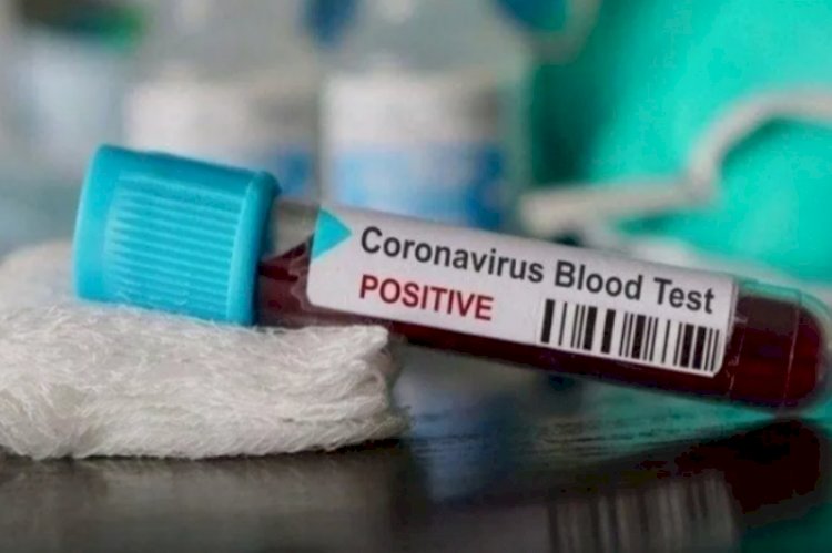 Wakil Gubernur Sulawesi Tenggara Terkonfirmasi Positif COVID-19