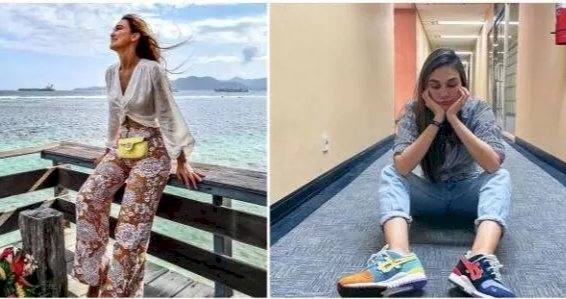 Patah Tulang, Begini Kondisi Terkini Luna Maya