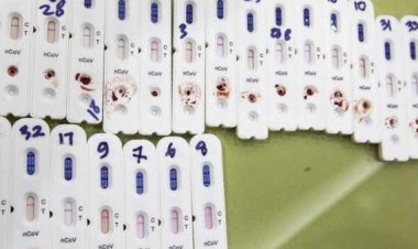 81 Penghuni Lapas Kelas II A Kota Jambi Reaktif, Johansyah: Segera Kita Lakukan Uji Swab