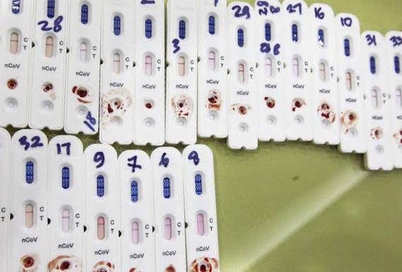 81 Penghuni Lapas Kelas II A Kota Jambi Reaktif, Johansyah: Segera Kita Lakukan Uji Swab