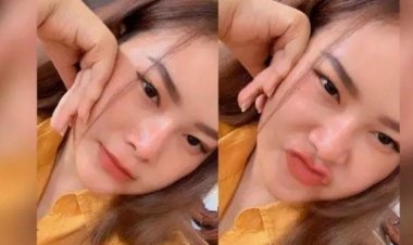 Selebgram Cantik Ini Bunuh Diri Lompat dari Lantai 4 Hotel, Dan Begini Penyebabnya