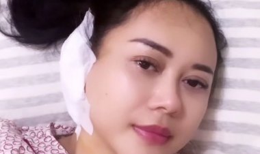 Gendang Telinga Bocor, Begini Kondisi Terkini Aura Kasih