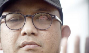 Polri juga Mediasi Selesaikan Cuitan Twitter Novel Baswedan Soal Wafatnya Maaher At-Thuwailibi