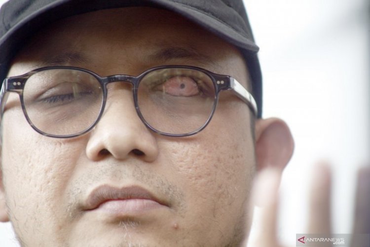 Polri juga Mediasi Selesaikan Cuitan Twitter Novel Baswedan Soal Wafatnya Maaher At-Thuwailibi
