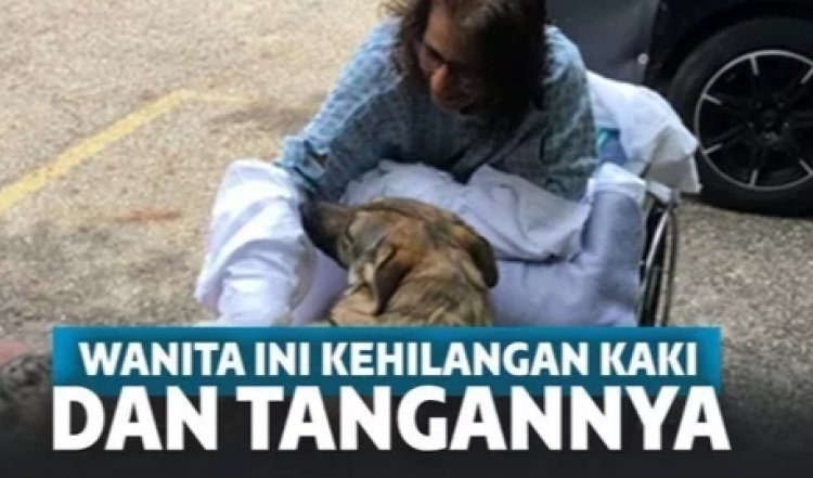 Gegara Dijilati Anjing Peliharaan, Wanita Ini Hilang Tangan dan Kakinya