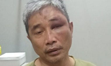 Pengacara Irjen Napoleon Bonaparte Bantah Klien Aniaya M Kace, Polisi: Keterangan Calon Tersangka tidak Penting