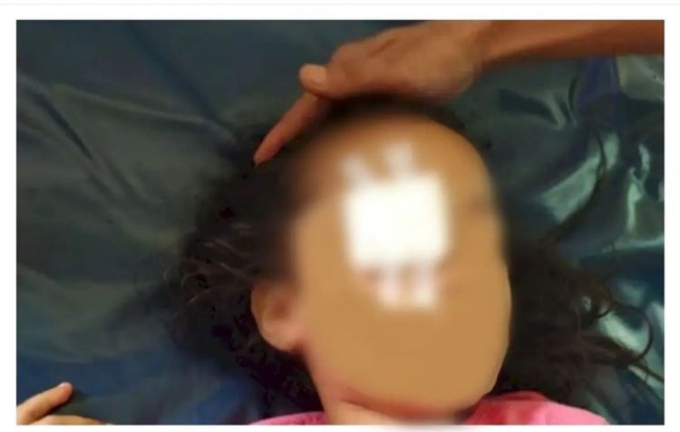 Tega! Ibu dan Ayah Cungkil Mata Anak Perempuan Mereka: Assulukko! Assulukko!