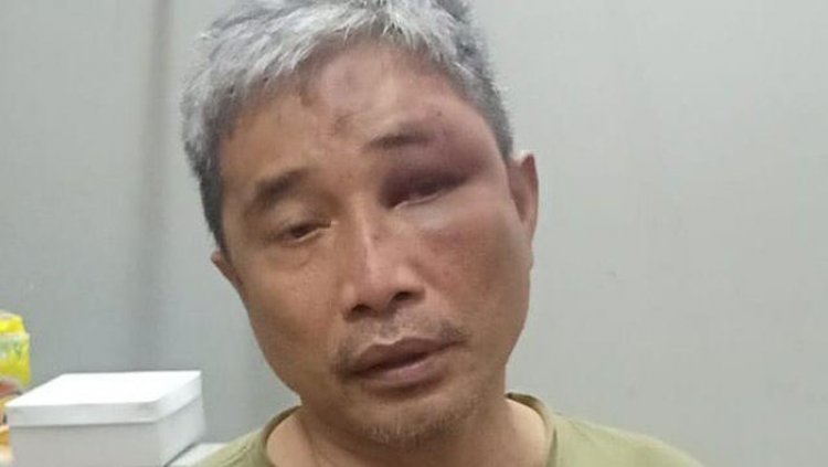 Pengacara Irjen Napoleon Bonaparte Bantah Klien Aniaya M Kace, Polisi: Keterangan Calon Tersangka tidak Penting