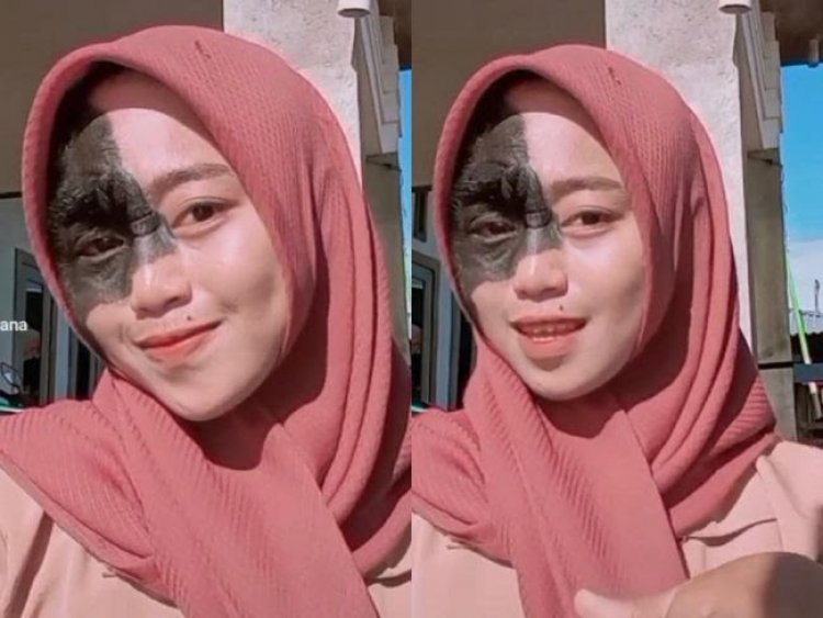 Hijabers Cantik Ini Viral Dibully karena Ada Tanda Lahir, Tapi Siapa Sangka!