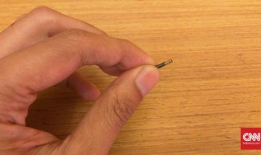 Viral! Implan Mikrocip Sebesar Beras Ditanam di Tangan