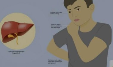 Disebut Hepatitis Akut Terkait dengan Vaksinasi COVID-19, RSPI: Hoax!