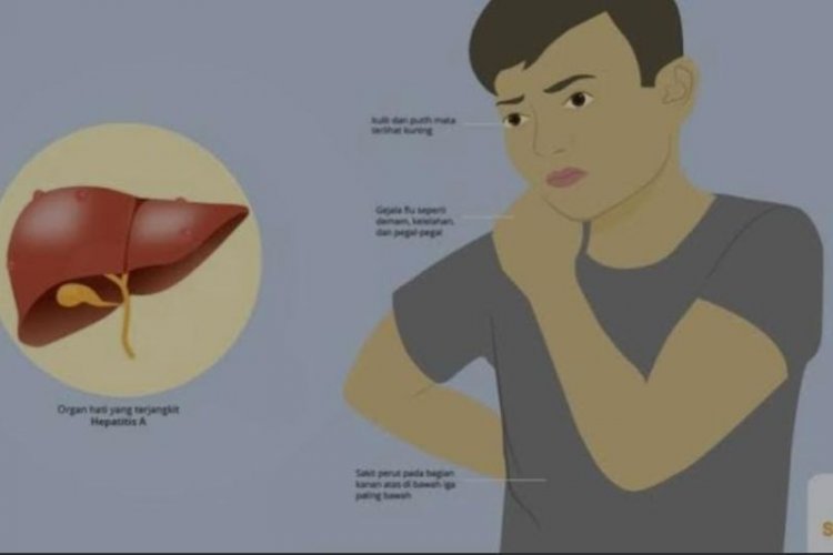 Disebut Hepatitis Akut Terkait dengan Vaksinasi COVID-19, RSPI: Hoax!