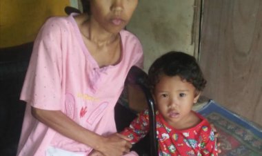 Miliki Anak yang Masih Kecil, Seorang Ibu di Muarojambi Harus Berjuang Melawan Tumor Ganas