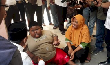 Begini Cara Wabup Karawang Bujuk Bocah Obesitas Agar Mau Diperiksa