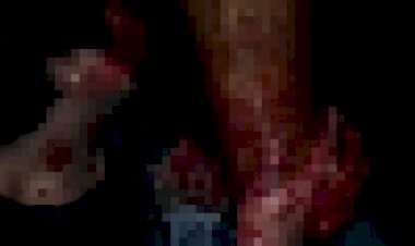 Dua Pemuda di Tebo Bonyok, Kuat Dugaan Korban Pengeroyokan