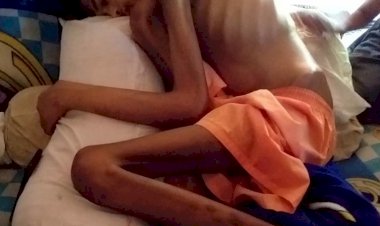 Tinggal Kulit Pembalut Tulang Karena Sakit, Rachju Anak Yatim ini Butuh Uluran Tangan