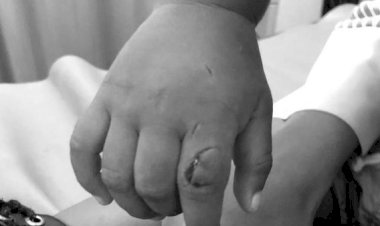 Ikan Aligator di Lapas Wanita Bandung Gigit Balita