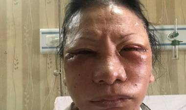 Dihantui Rasa Trauma dan Ketakutan, Ini Kronologis Lengkap Penganiayaan Ratna Sarumpaet