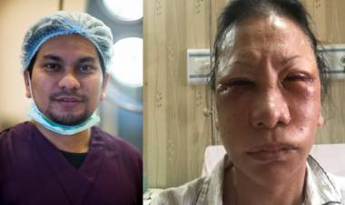 Karena Bohong, Tompi Pasang Tarif Operasi Plastik ke Ratna Sarumpaet 