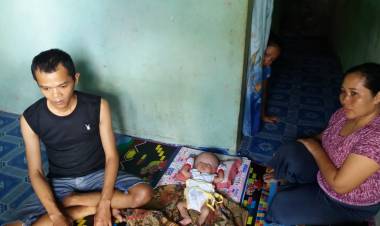 Bayi Malang Ini Butuh Uluran Tangan Pemerintah