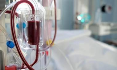 Bikin Penasaran, Berapa Sih Harga Selang Cuci Darah Kata Prabowo 40 Kali Pakai?