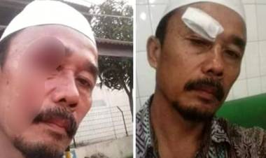 Nah Giliran Ustadz Pun Dianiya Wanita, Ini Kata MUI