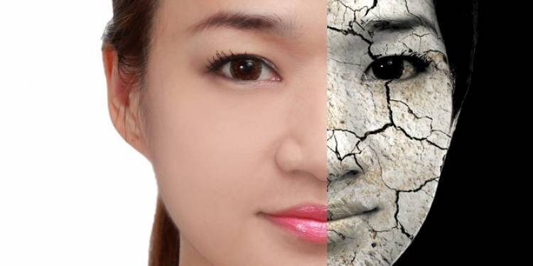 6 Gejala kerusakan di wajah yang menandakan ritual kecantikanmu perlu diubah