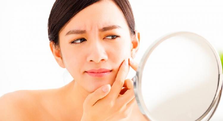 Teknik Perawatan Kuno yang Ampuh Hilangkan Jerawat dengan Oil Pulling