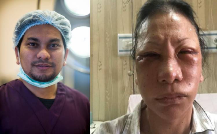 Karena Bohong, Tompi Pasang Tarif Operasi Plastik ke Ratna Sarumpaet 