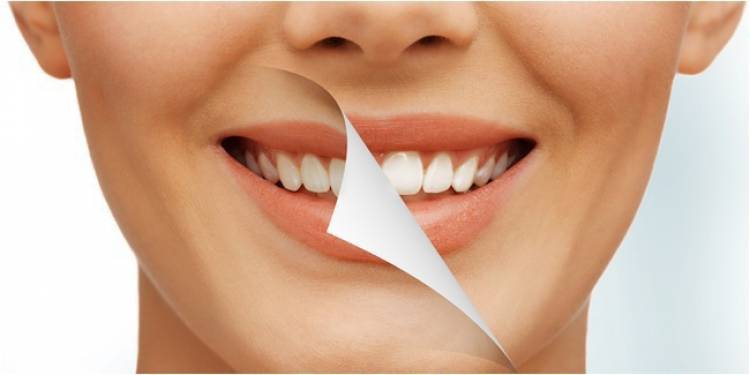 Cara Memutihkan Gigi dengan Kunyit