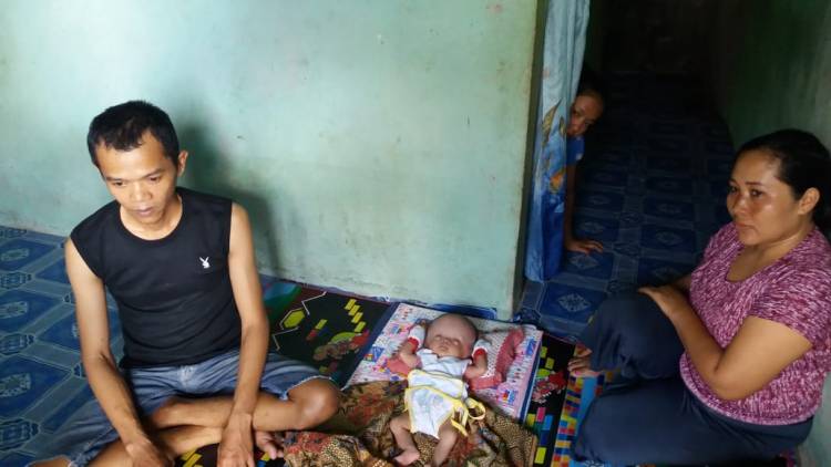 Bayi Malang Ini Butuh Uluran Tangan Pemerintah