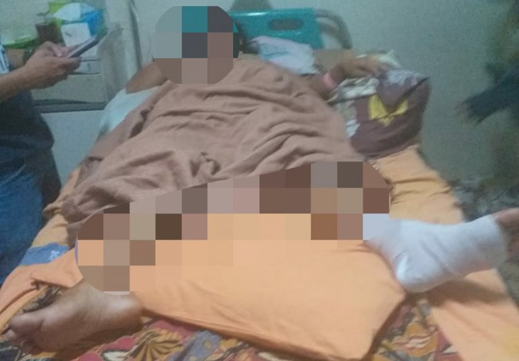 Nyaris Diperkosa, Wanita Cantik Ini Patah Kaki Terjun di Ketinggian 7 Meter