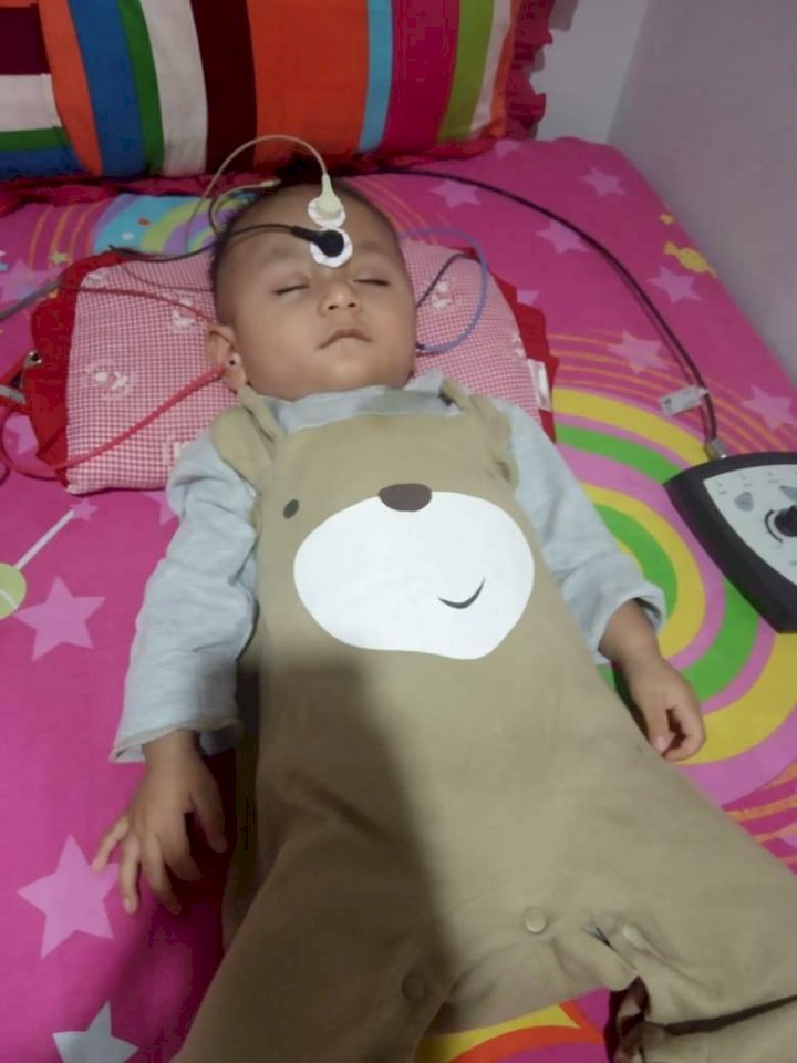 Butuh Biaya Pengobatan Ratusan Juta, Balita Merangin Ini Butuh Perhatian