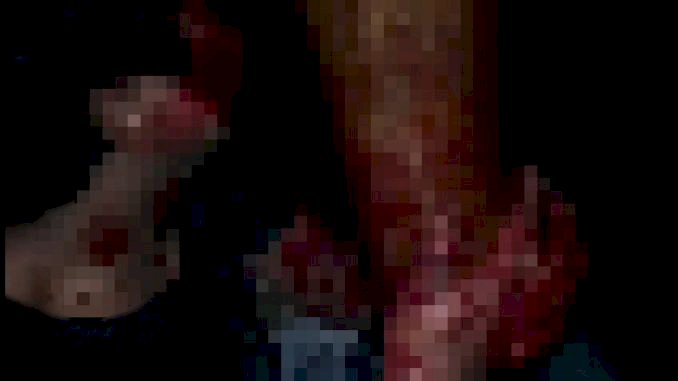 Dua Pemuda di Tebo Bonyok, Kuat Dugaan Korban Pengeroyokan