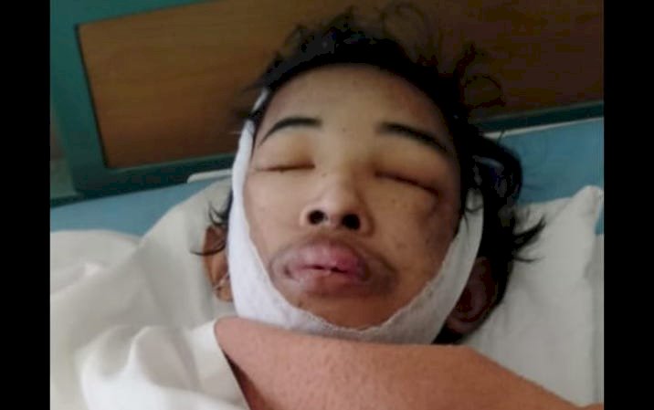 BREAKING NEWS!! Dinyatakan Meninggal, Pengidap Tumor Paru Racjhu Dikabarkan Bernafas Kembali Usai Dimandikan