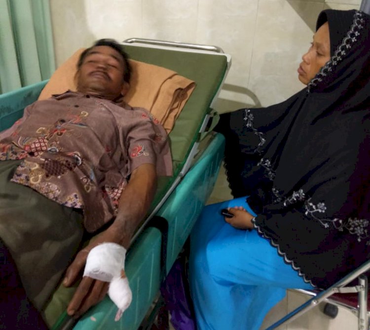 Padamkan Api Karhutla, Anggota Regu Pemadam Perusahan Pasrah Kehilangan Jari Kelingking